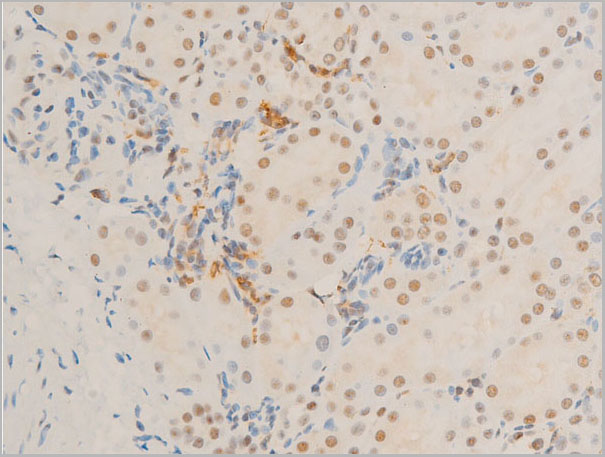 product-image-AAA30965_IHC5.jpg