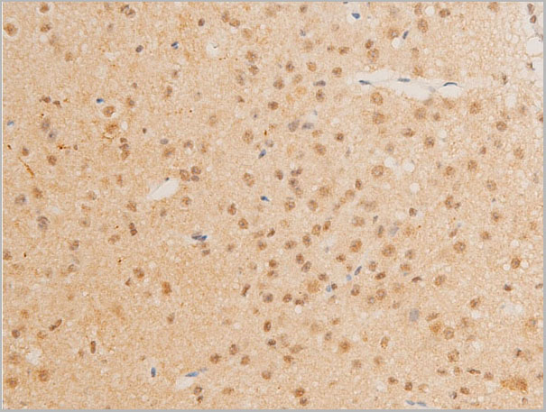 product-image-AAA30966_IHC2.jpg