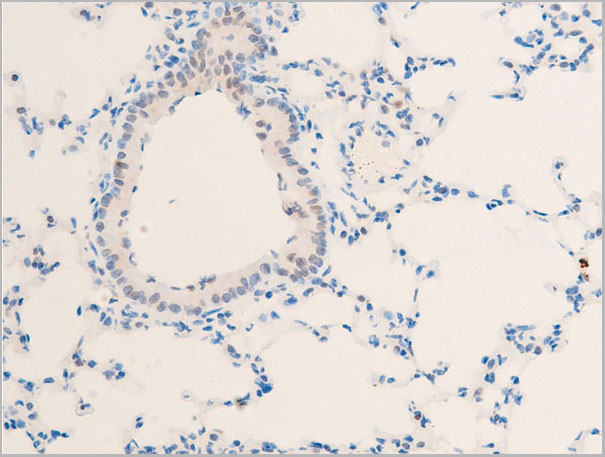 product-image-AAA30966_IHC3.jpg