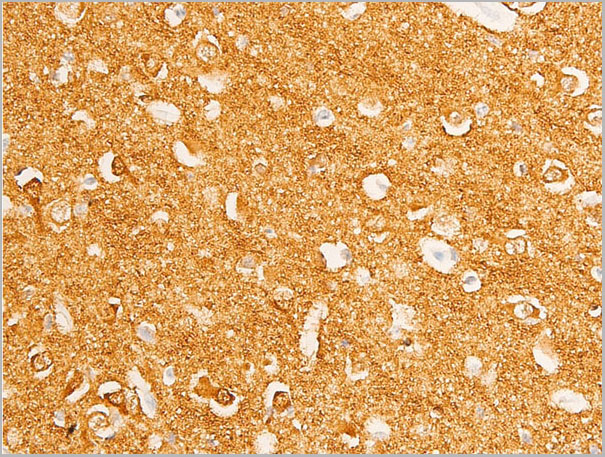 product-image-AAA30966_IHC5.jpg