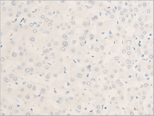 product-image-AAA30966_IHC6.jpg