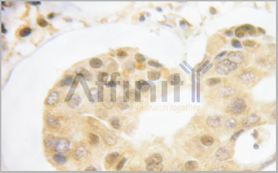 product-image-AAA30967_IHC5.jpg