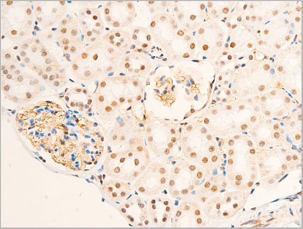 product-image-AAA30968_IHC3.jpg