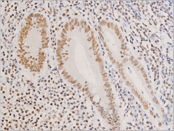 product-image-AAA30968_IHC6.jpg