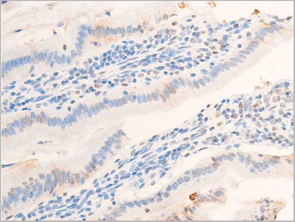 product-image-AAA30969_IHC10.jpg