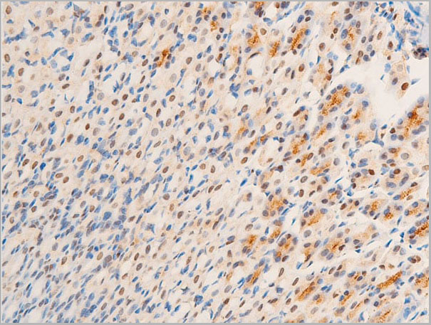product-image-AAA30969_IHC2.jpg