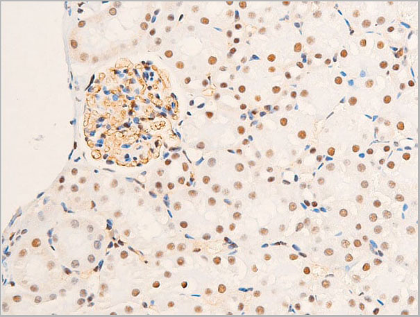 product-image-AAA30969_IHC3.jpg