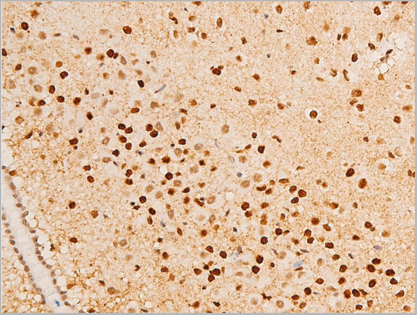 product-image-AAA30969_IHC4.jpg