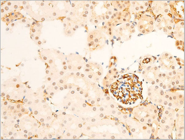 product-image-AAA30970_IHC3.jpg