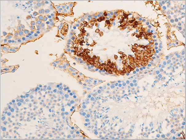 product-image-AAA30970_IHC5.jpg