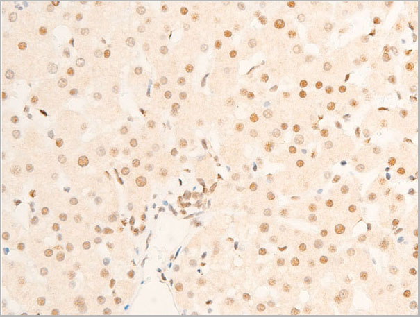 product-image-AAA30970_IHC7.jpg