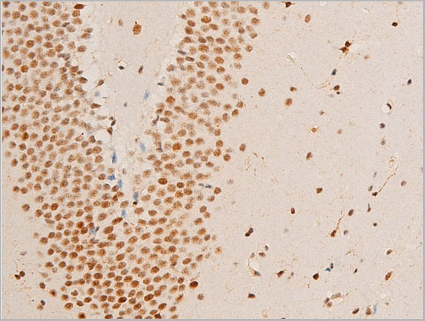 product-image-AAA30971_IHC2.jpg