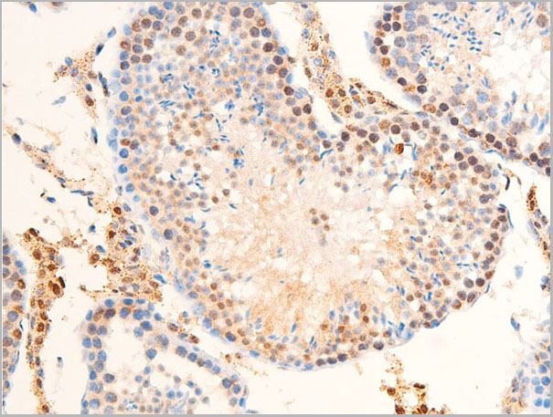 product-image-AAA30971_IHC3.jpg