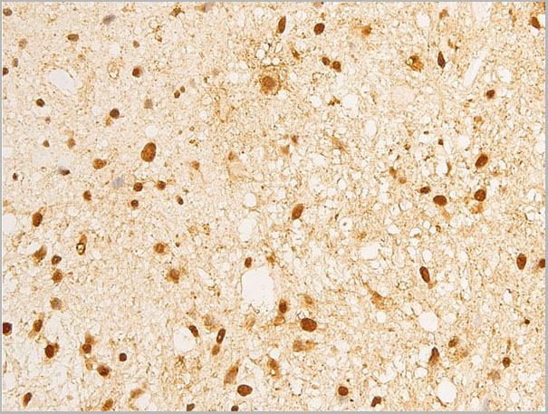 product-image-AAA30971_IHC5.jpg