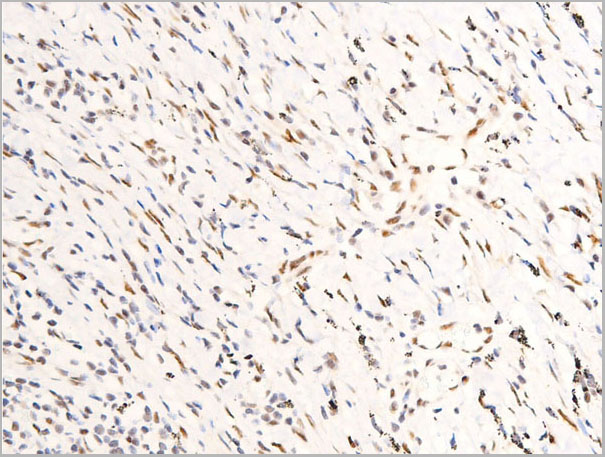 product-image-AAA30971_IHC6.jpg