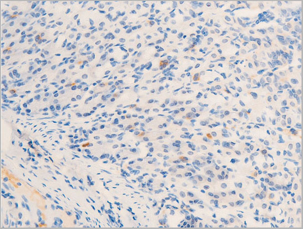 product-image-AAA30972_IHC2.jpg