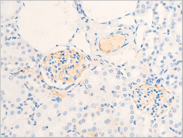 product-image-AAA30972_IHC3.jpg