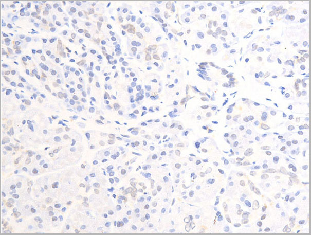 product-image-AAA30972_IHC5.jpg