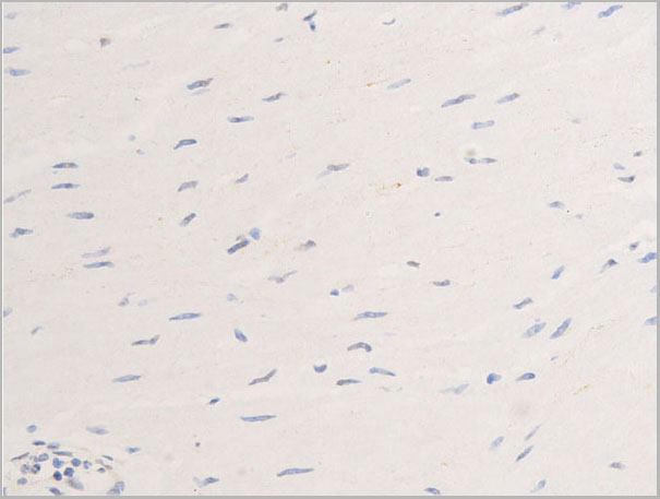 product-image-AAA30972_IHC6.jpg