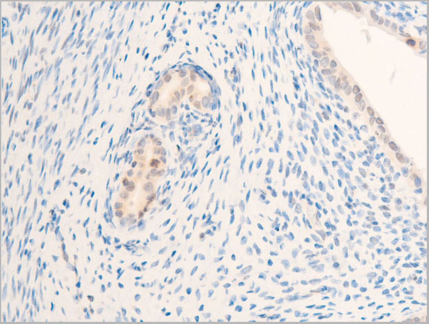 product-image-AAA30972_IHC8.jpg