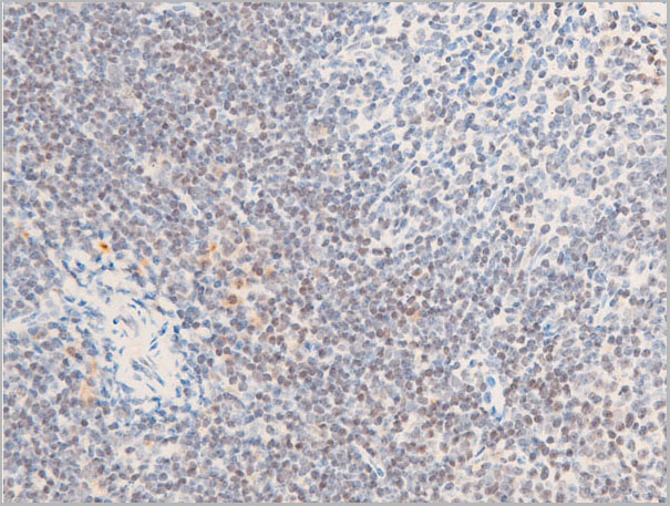 product-image-AAA30973_IHC2.jpg