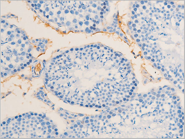 product-image-AAA30973_IHC3.jpg