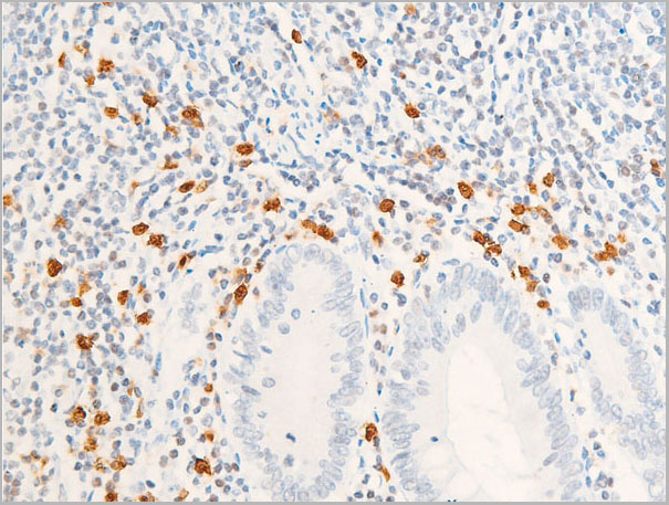 product-image-AAA30973_IHC4.jpg