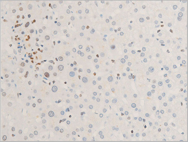 product-image-AAA30973_IHC5.jpg