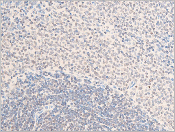 product-image-AAA30973_IHC8.jpg