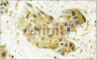 product-image-AAA30976_IHC.jpg