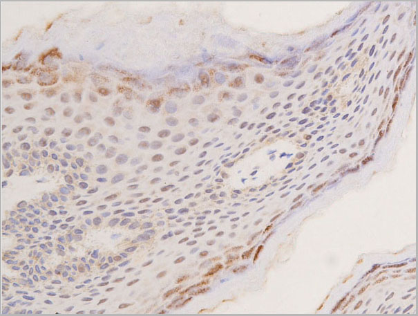 product-image-AAA30976_IHC2.jpg