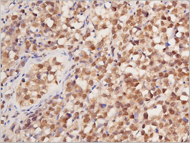 product-image-AAA30976_IHC3.jpg