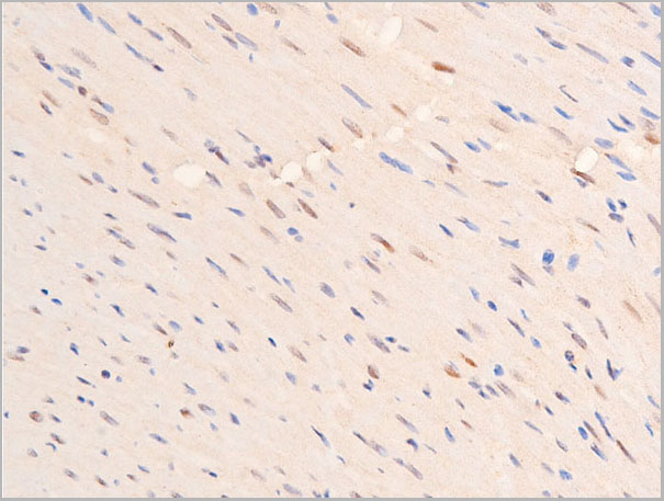product-image-AAA30976_IHC9.jpg