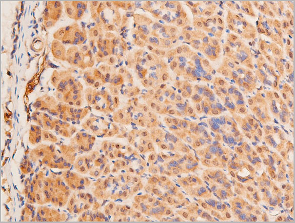 product-image-AAA30977_IHC2.jpg