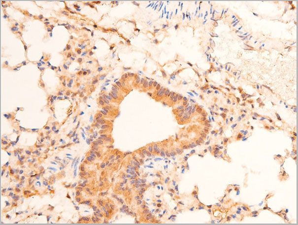 product-image-AAA30977_IHC3.jpg