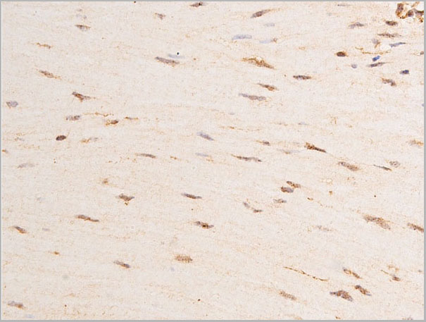 product-image-AAA30977_IHC4.jpg