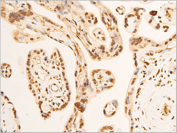 product-image-AAA30978_IHC2.jpg