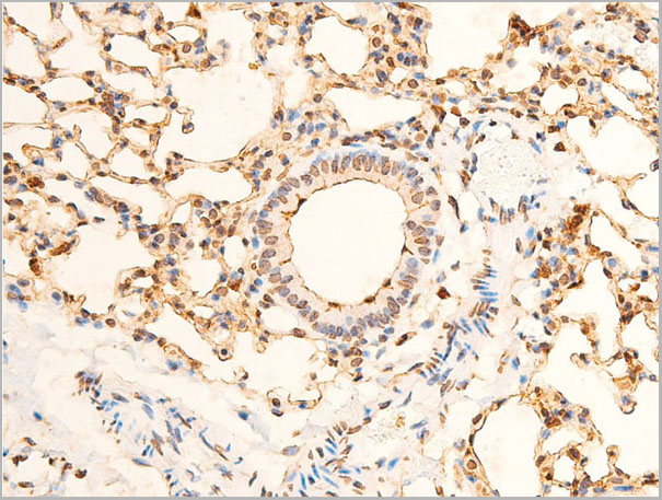 product-image-AAA30978_IHC8.jpg