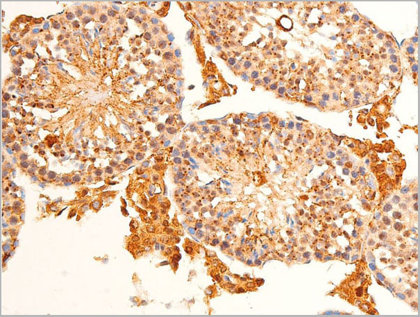 product-image-AAA30980_IHC3.jpg