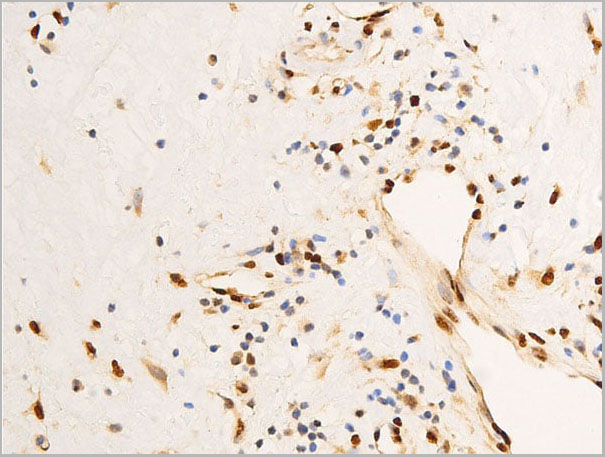 product-image-AAA30980_IHC5.jpg