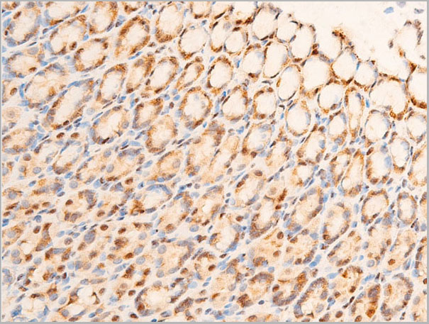 product-image-AAA30980_IHC7.jpg