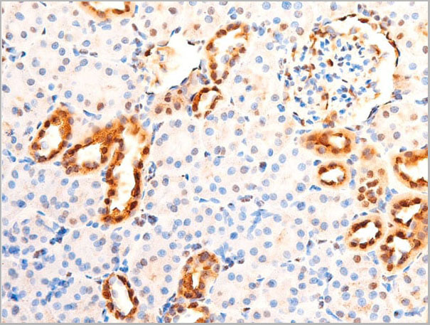 product-image-AAA30980_IHC8.jpg