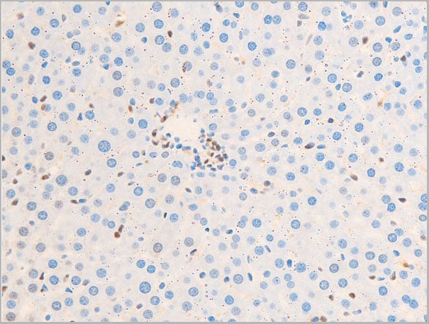 product-image-AAA30980_IHC9.jpg