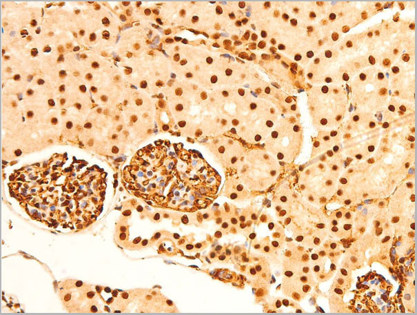 product-image-AAA30981_IHC2.jpg