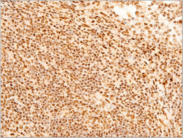 product-image-AAA30981_IHC5.jpg