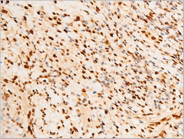 product-image-AAA30981_IHC6.jpg