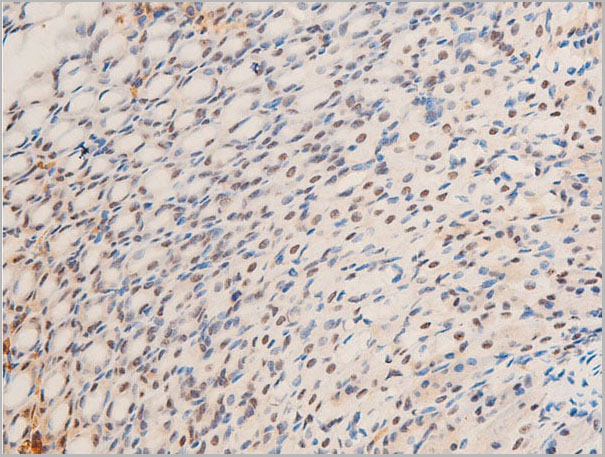 product-image-AAA30982_IHC2.jpg