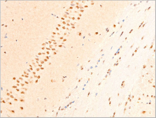 product-image-AAA30982_IHC3.jpg
