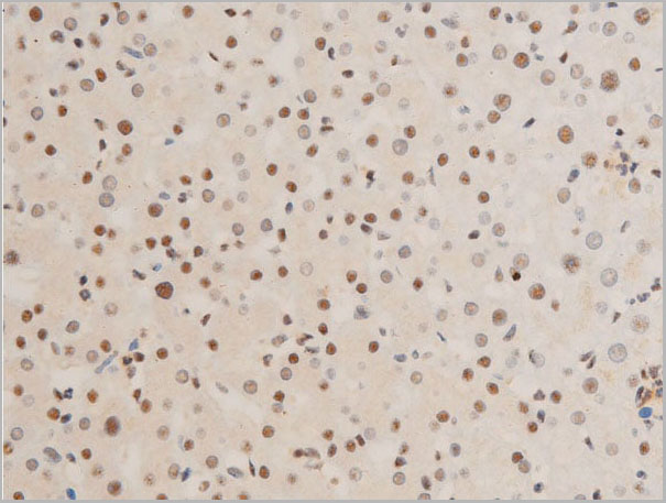 product-image-AAA30982_IHC6.jpg