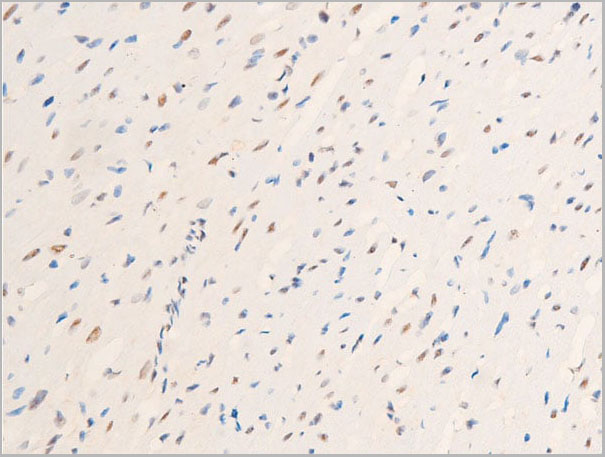 product-image-AAA30982_IHC8.jpg